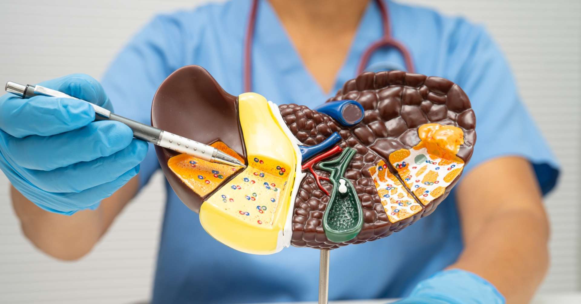 Masna jetra – tiha epidemija današnjice